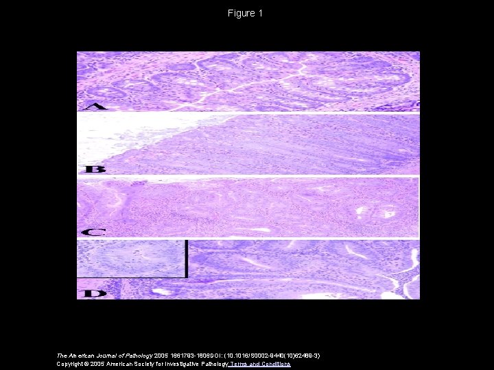 Figure 1 The American Journal of Pathology 2005 1661793 -1806 DOI: (10. 1016/S 0002