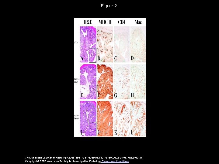 Figure 2 The American Journal of Pathology 2005 1661793 -1806 DOI: (10. 1016/S 0002