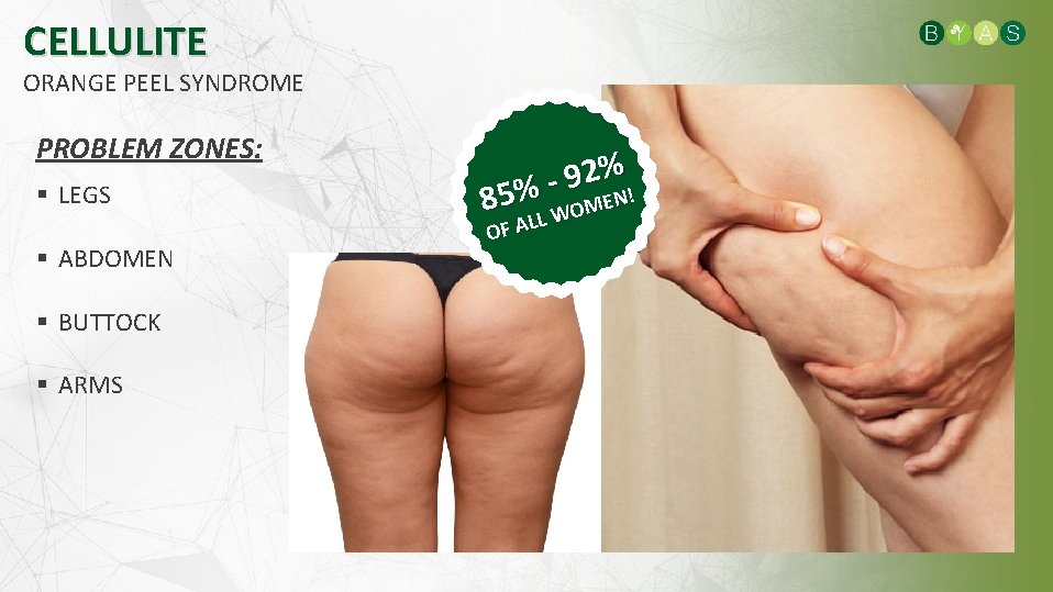 CELLULITE ORANGE PEEL SYNDROME PROBLEM ZONES: LEGS ABDOMEN BUTTOCK ARMS 2% 9 85%L WOMEN!