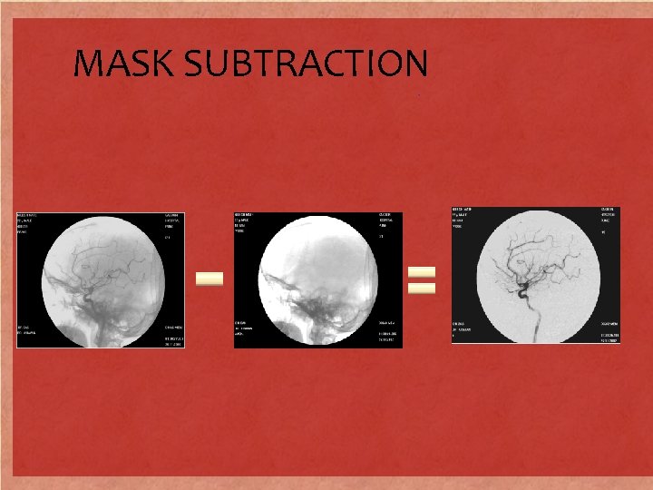 MASK SUBTRACTION 