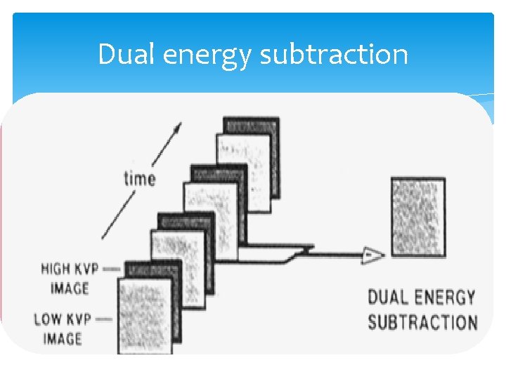 Dual energy subtraction 