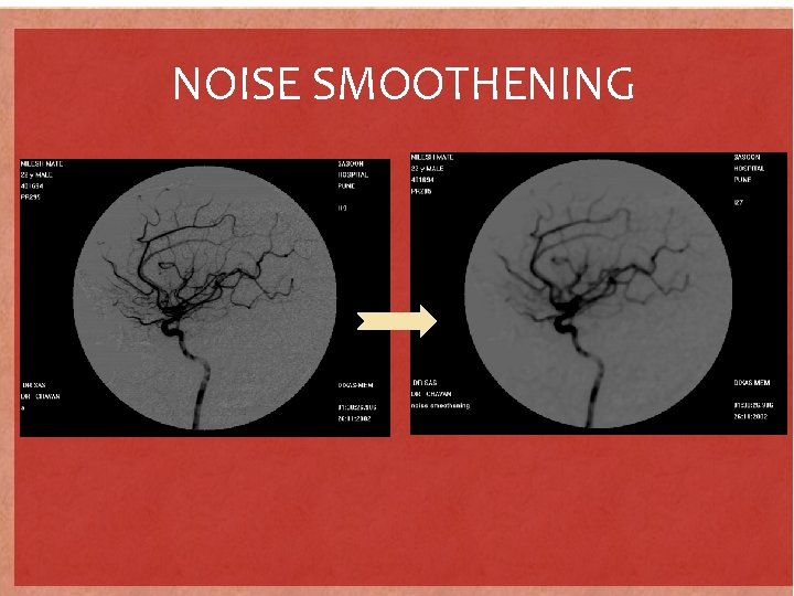NOISE SMOOTHENING 