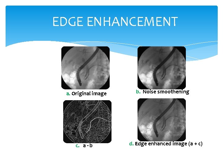 EDGE ENHANCEMENT a. Original image c. a - b b. Noise smoothening d. Edge