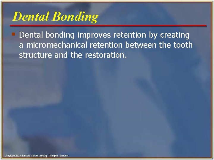 Dental Bonding § Dental bonding improves retention by creating a micromechanical retention between the Dental Bonding § Dental bonding improves retention by creating a micromechanical retention between the