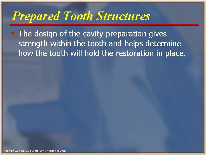 Prepared Tooth Structures § The design of the cavity preparation gives strength within the