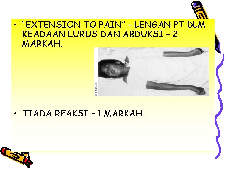  • “EXTENSION TO PAIN” – LENGAN PT DLM KEADAAN LURUS DAN ABDUKSI –