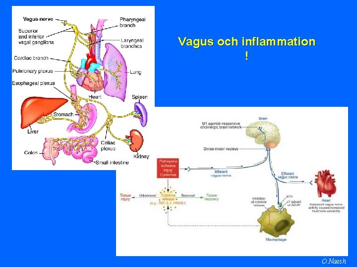 Vagus och inflammation ! O. Naesh 