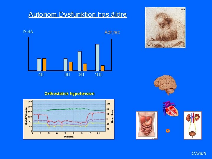 Autonom Dysfunktion hos äldre P-NA Adr, rec 40 60 80 100 Orthostatisk hypotension O.