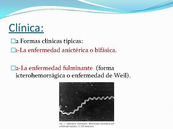 Clínica: � 2 Formas clínicas típicas: � 1 -La enfermedad anictérica o bifásica. �
