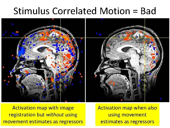 Stimulus Correlated Motion = Bad Activation map with image registration but without using movement