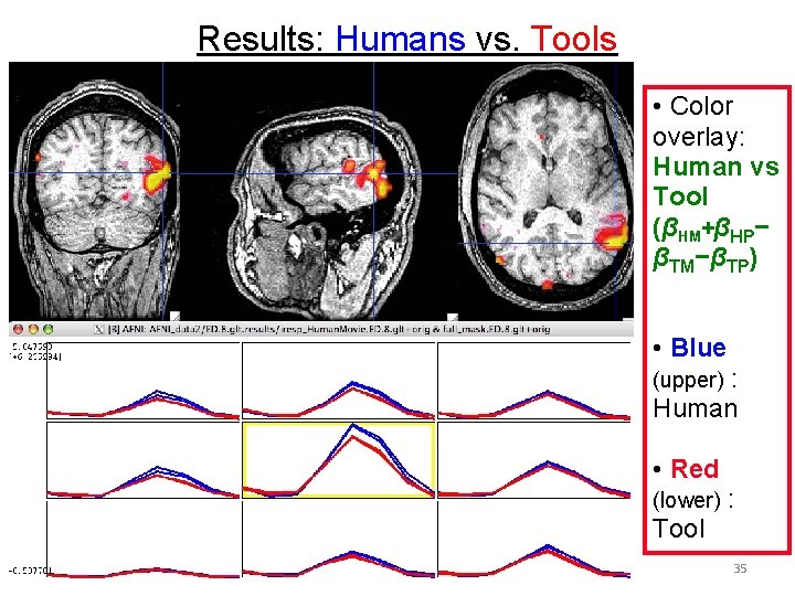 Results: Humans vs. Tools • Color overlay: Human vs Tool (βHM+βHP− βTM−βTP) • Blue