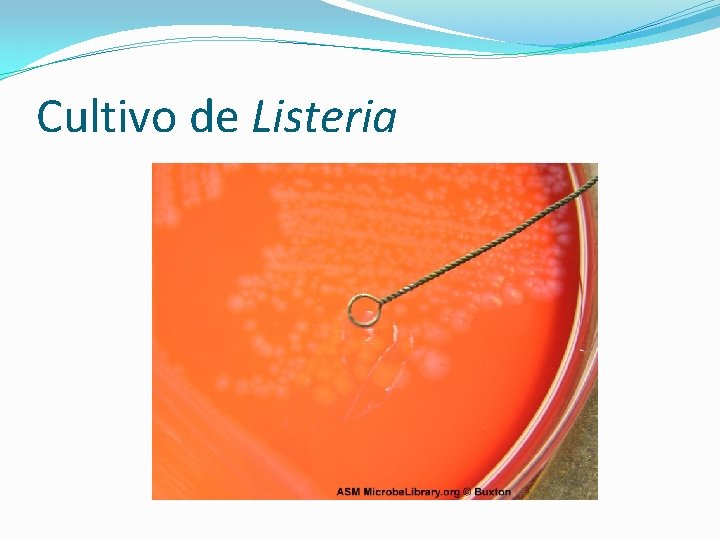 Cultivo de Listeria 