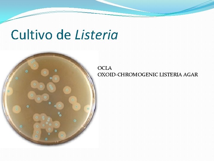 Cultivo de Listeria OCLA OXOID-CHROMOGENIC LISTERIA AGAR 