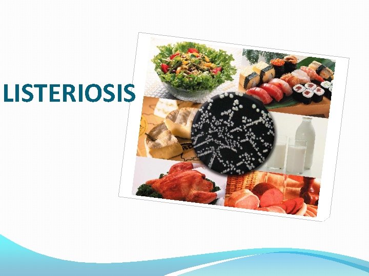 LISTERIOSIS 