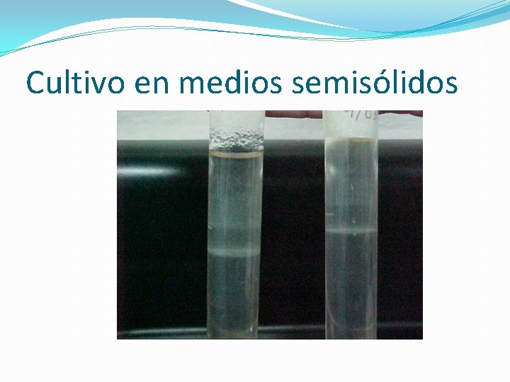 Cultivo en medios semisólidos 