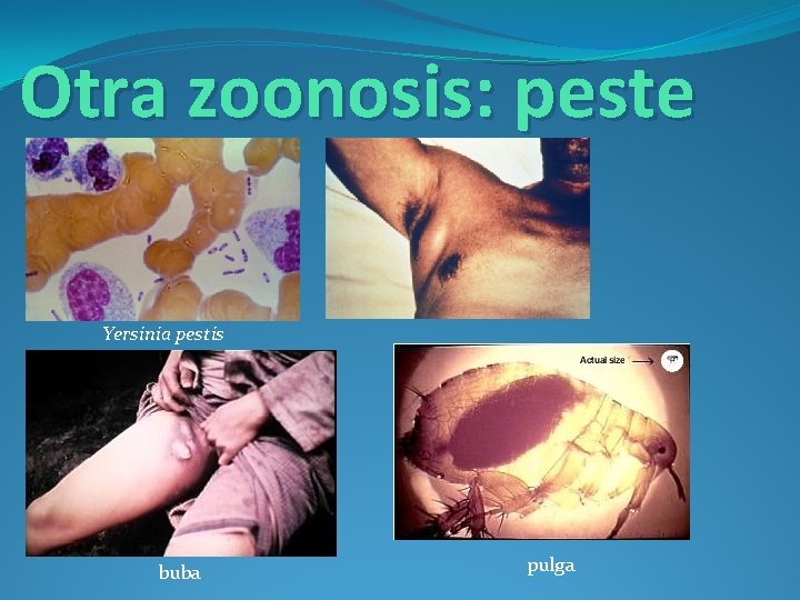 Otra zoonosis: peste Yersinia pestis buba pulga 