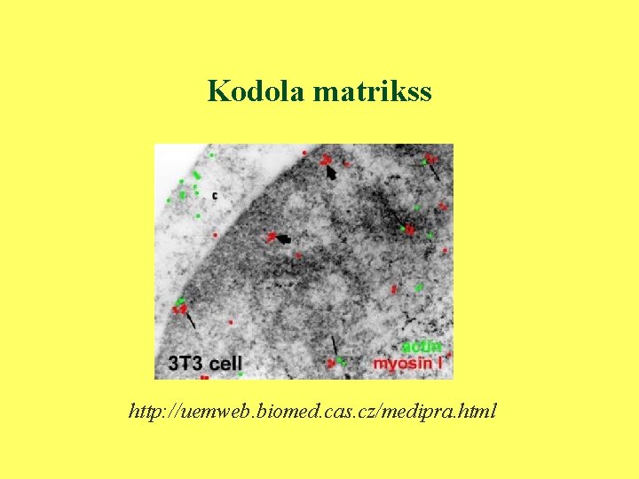 Kodola matrikss http: //uemweb. biomed. cas. cz/medipra. html 