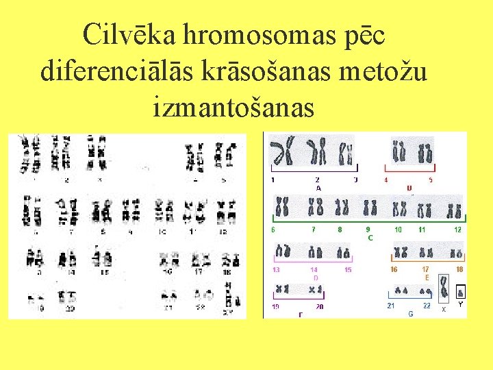 Cilvēka hromosomas pēc diferenciālās krāsošanas metožu izmantošanas 