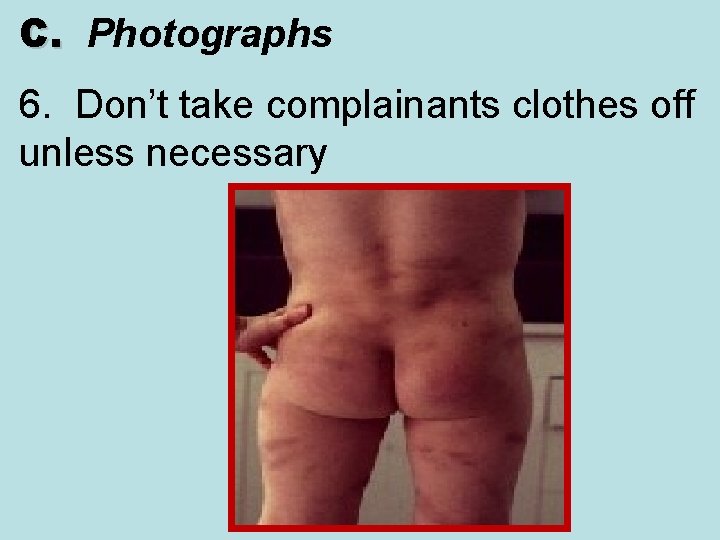 C. Photographs C. 6. Don’t take complainants clothes off unless necessary 