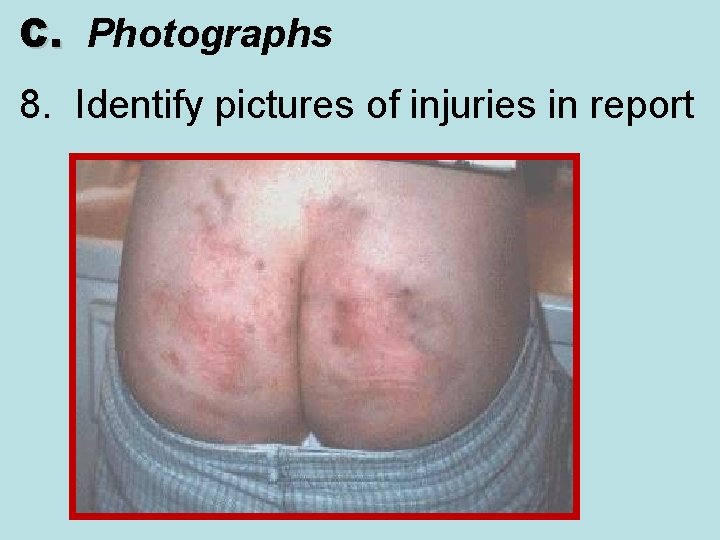 C. Photographs C. 8. Identify pictures of injuries in report 