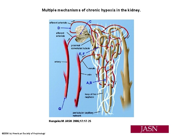 Multiple mechanisms of chronic hypoxia in the kidney. Nangaku M JASN 2006; 17: 17