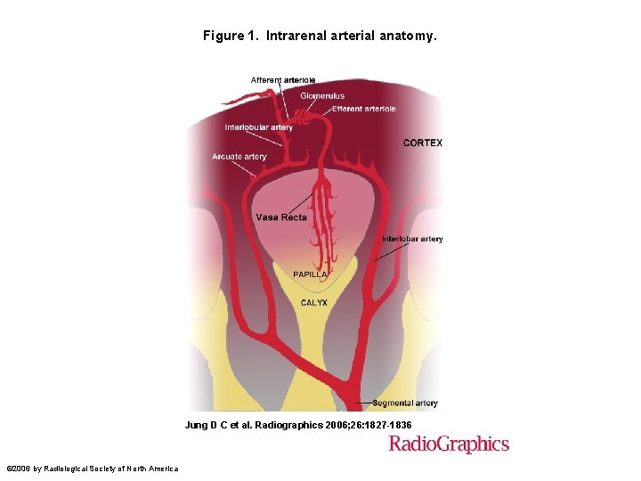 Figure 1. Intrarenal arterial anatomy. Jung D C et al. Radiographics 2006; 26: 1827