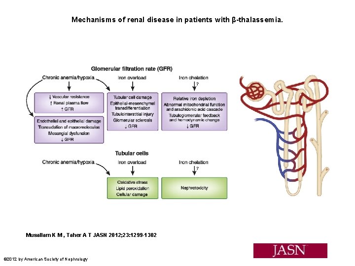 Mechanisms of renal disease in patients with β-thalassemia. Musallam K M , Taher A