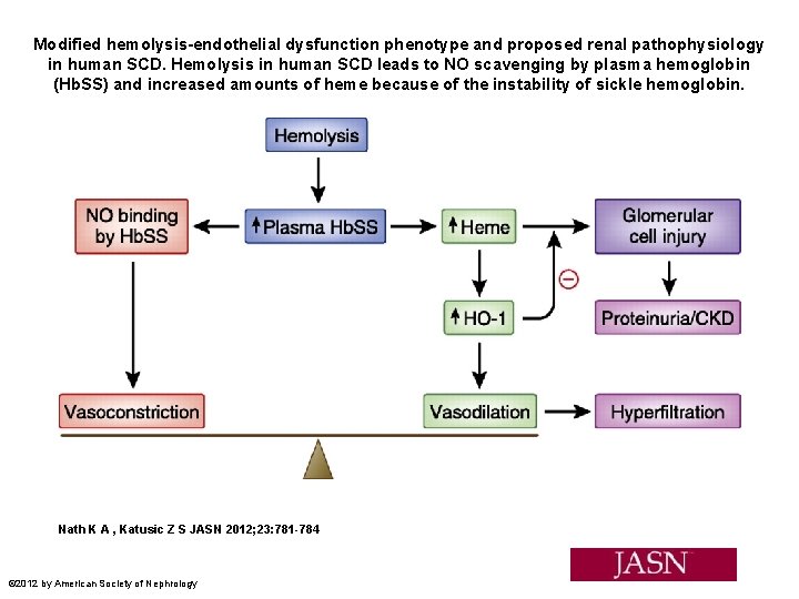 Modified hemolysis-endothelial dysfunction phenotype and proposed renal pathophysiology in human SCD. Hemolysis in human