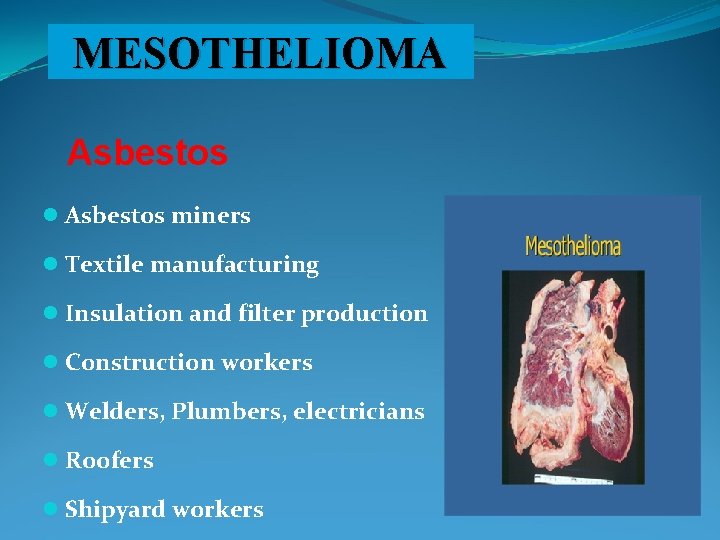 MESOTHELIOMA Asbestos l Asbestos miners l Textile manufacturing l Insulation and filter production l