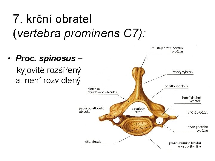 7. krční obratel (vertebra prominens C 7): • Proc. spinosus – kyjovitě rozšířený a