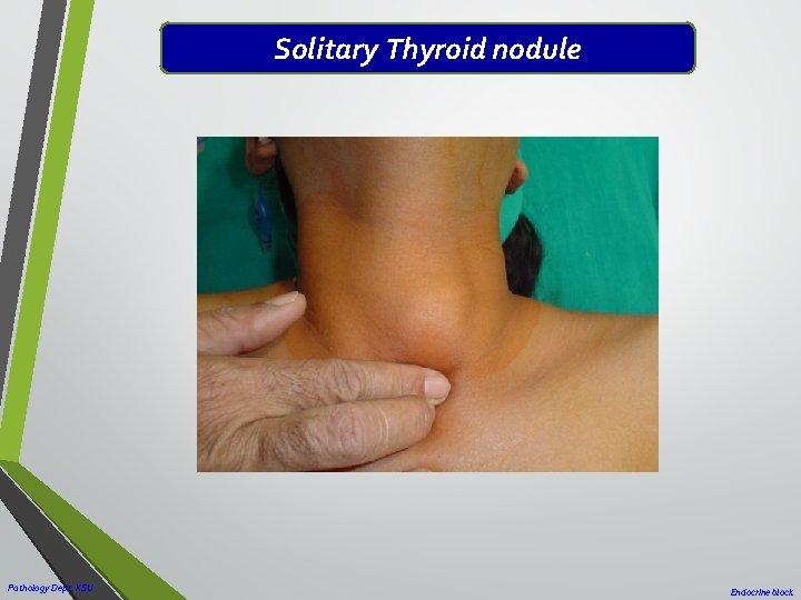 Solitary Thyroid nodule Pathology Dept. KSU Endocrine block 