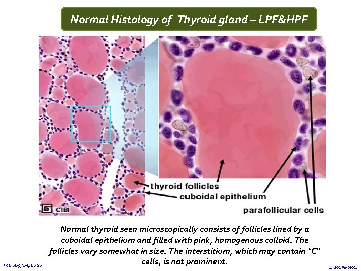Normal Histology of Thyroid gland – LPF&HPF Pathology Dept. KSU Normal thyroid seen microscopically