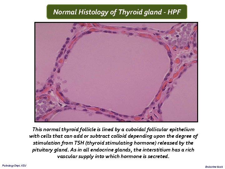 Normal Histology of Thyroid gland - HPF This normal thyroid follicle is lined by
