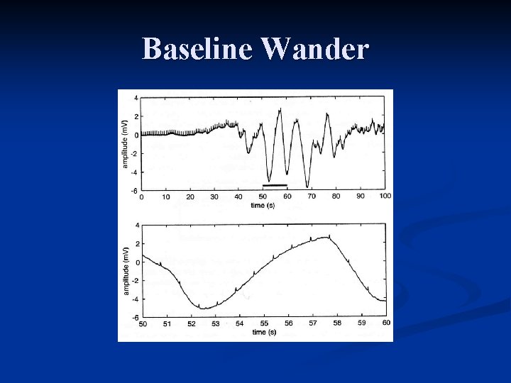 Baseline Wander 