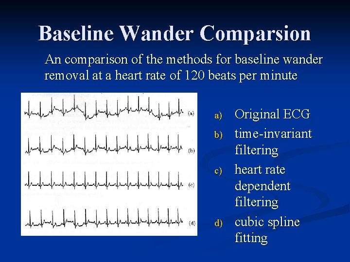 Baseline Wander Comparsion An comparison of the methods for baseline wander removal at a