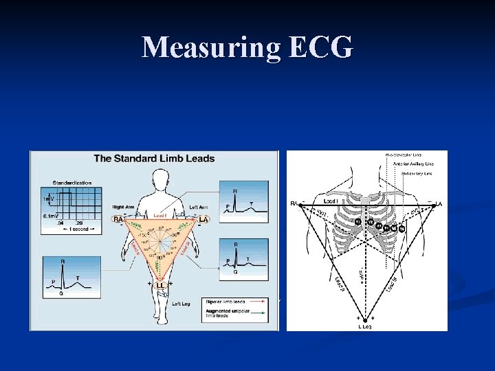 Measuring ECG n ECG commonly measured via 12 specifically placed leads 