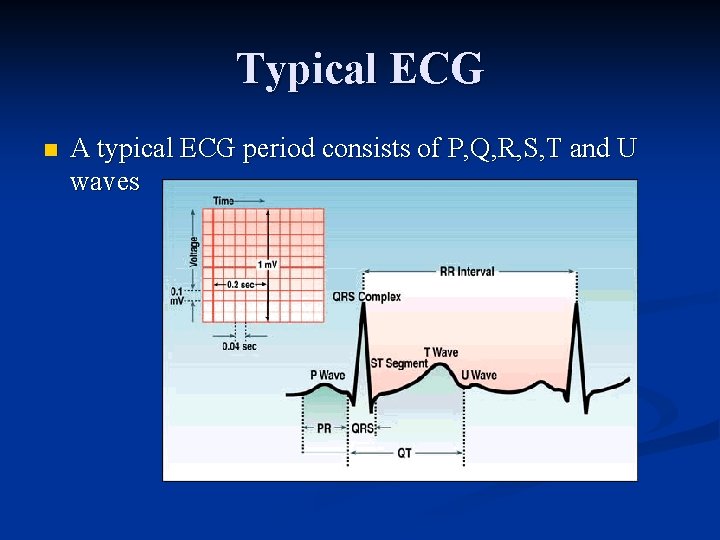 Typical ECG n A typical ECG period consists of P, Q, R, S, T