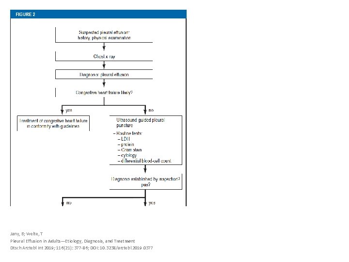 Jany, B; Welte, T Pleural Effusion in Adults—Etiology, Diagnosis, and Treatment Dtsch Arztebl Int