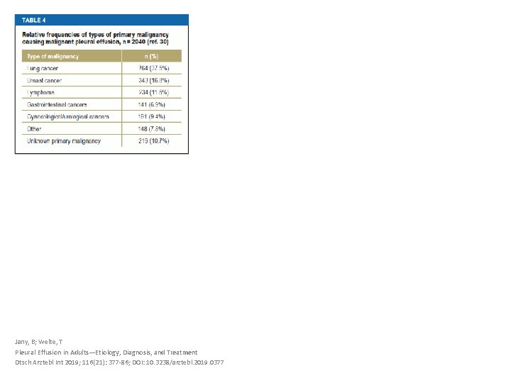 Jany, B; Welte, T Pleural Effusion in Adults—Etiology, Diagnosis, and Treatment Dtsch Arztebl Int