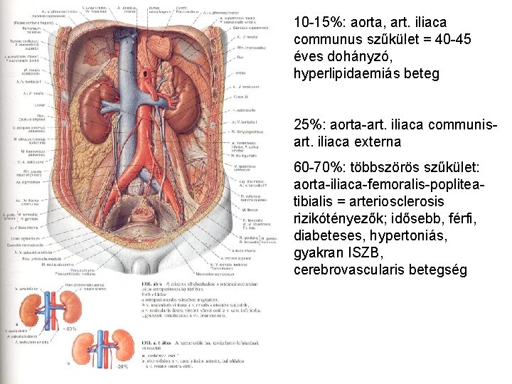 10 -15%: aorta, art. iliaca communus szűkület = 40 -45 éves dohányzó, hyperlipidaemiás beteg