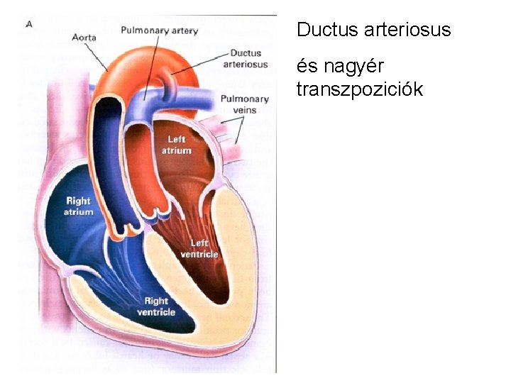 Ductus arteriosus és nagyér transzpoziciók 