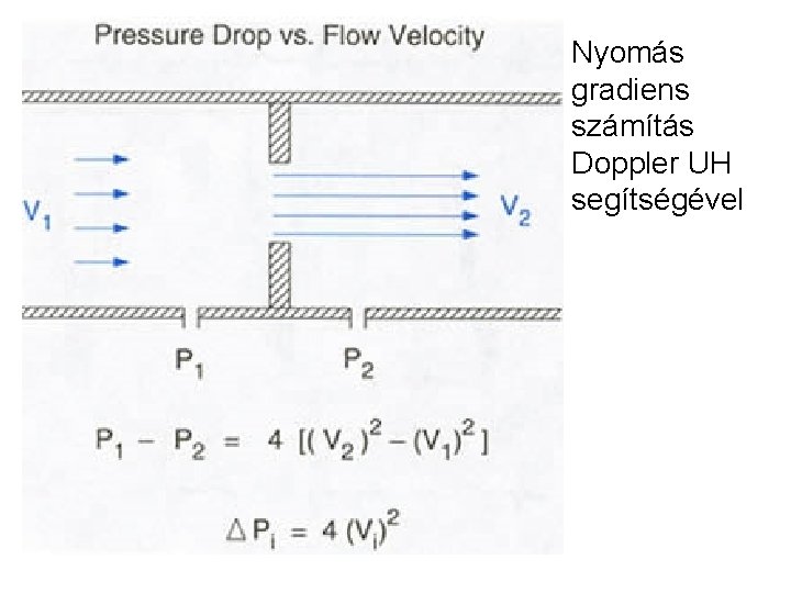 Nyomás gradiens számítás Doppler UH segítségével 