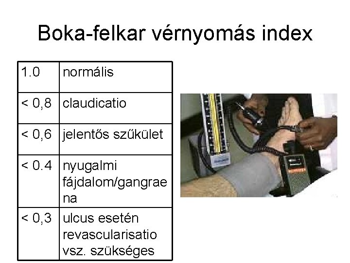 Boka-felkar vérnyomás index 1. 0 normális < 0, 8 claudicatio < 0, 6 jelentős