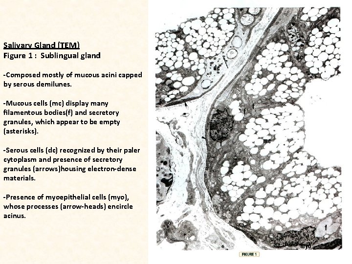 Salivary Gland (TEM) Figure 1 : Sublingual gland -Composed mostly of mucous acini capped