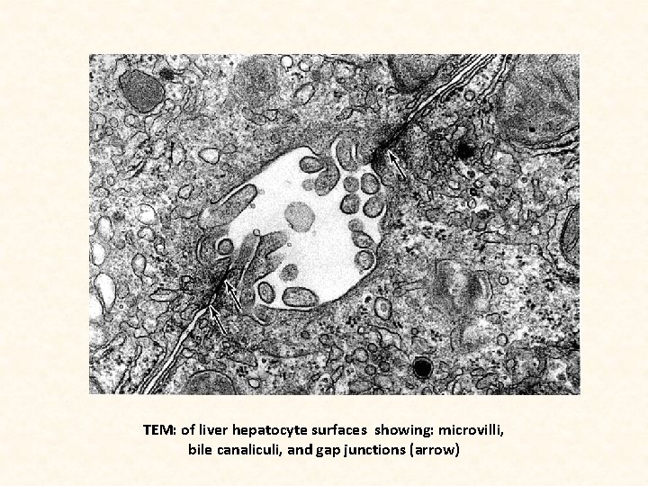 TEM: of liver hepatocyte surfaces showing: microvilli, bile canaliculi, and gap junctions (arrow) 