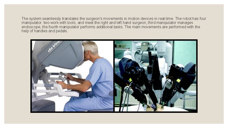 The system seamlessly translates the surgeon's movements in motion devices in real time. The