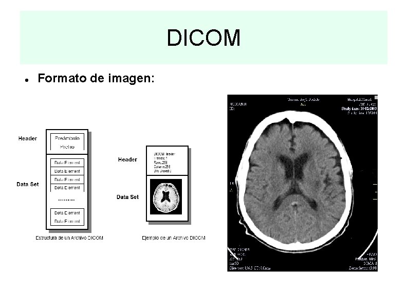 DICOM Formato de imagen: 