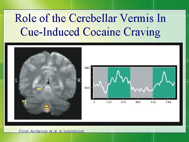 Role of the Cerebellar Vermis In Cue-Induced Cocaine Craving From Anderson et al. in