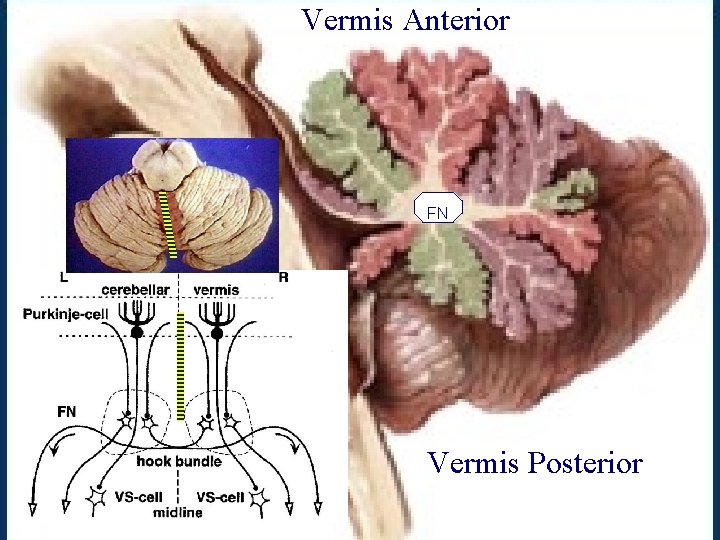 Vermis Anterior FN Vermis Posterior 