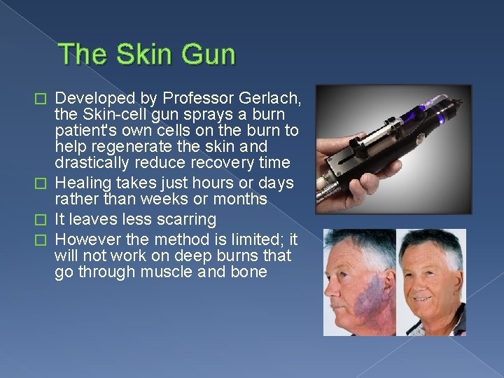 The Skin Gun Developed by Professor Gerlach, the Skin-cell gun sprays a burn patient's